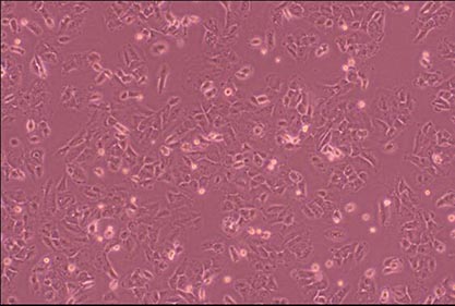 Human lung squamous cell carcinoma cells-BNCC