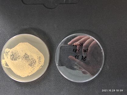 Streptomyces hygroscopicus subsp. hygroscopicus-BNCC