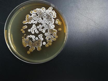 Streptomyces cacaoi subsp. asoensis-BNCC