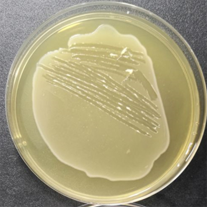 Listeria monocytogenes-BNCC