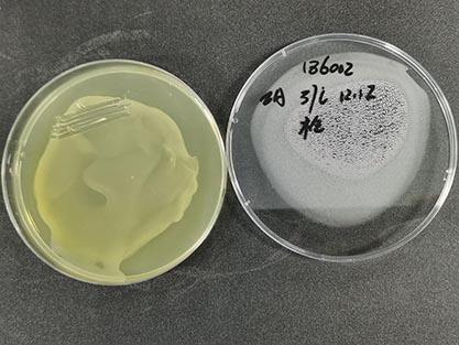 Mycobacterium abscessus-BNCC