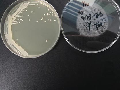 Schizosaccharomyces pombe-BNCC