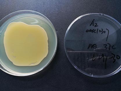 Staphylococcus aureus subspecies aureus-BNCC