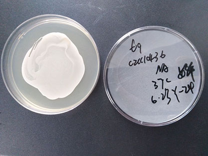 Staphylococcus epidermidis-BNCC