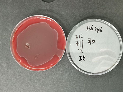Streptococcus pyogenes-BNCC