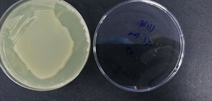 Escherichia coli O157-BNCC