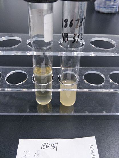 Escherichia coli STEC-BNCC