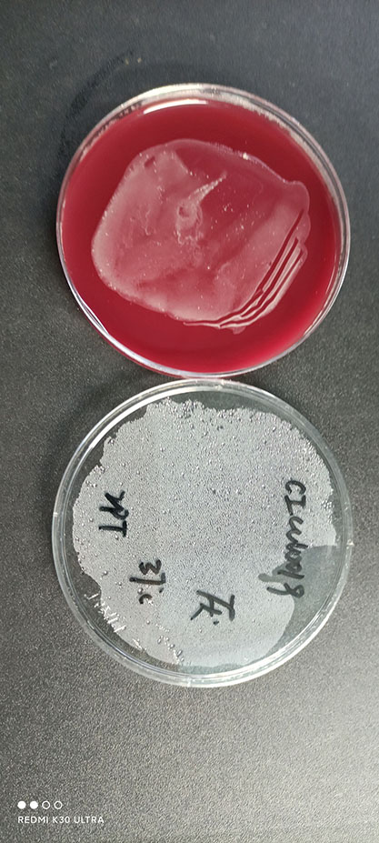 Propionibacterium freudenreichii-BNCC