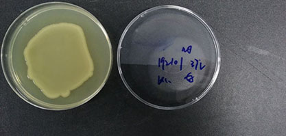 Escherichia coli EHEC O157:H7-BNCC