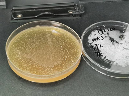 Bifidobacterium animalis subsp. lactis-BNCC