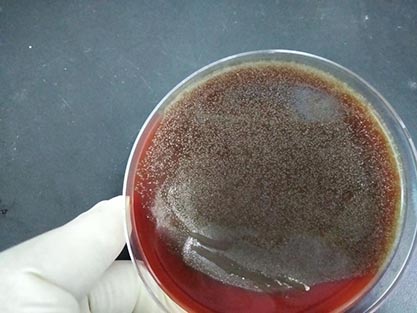 Streptococcus pneumoniae (Klein) Chester-BNCC