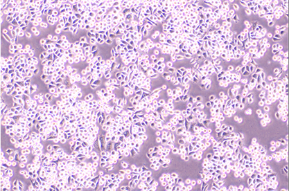 Human lung cancer cells-BNCC