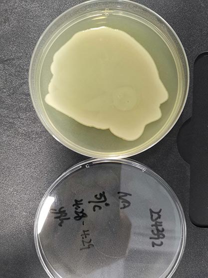 Acinetobacter baumannii Bouvet and Grimont-BNCC