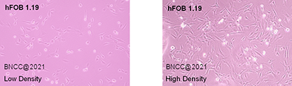 Human SV40 transfected osteoblasts-BNCC
