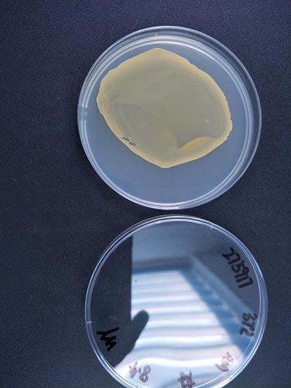 Staphylococcus aureus subspecies-BNCC