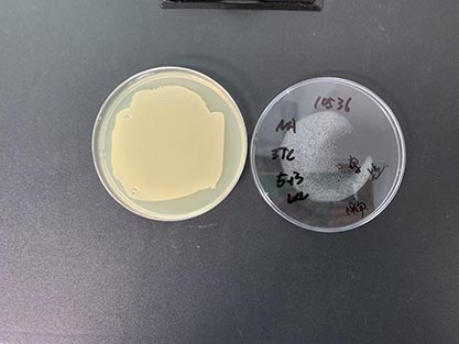 Escherichia coli-BNCC