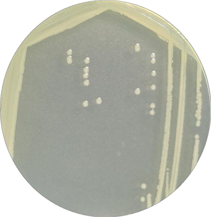 Escherichia coli (Migula) Castellani and Chalmers-BNCC