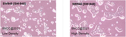 Human colon adenocarcinoma cells-BNCC