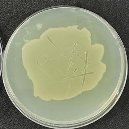 Escherichia coli (Migula) Castellani and Chalmers-BNCC