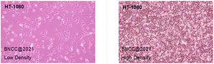 Human fibrosarcoma cells-BNCC