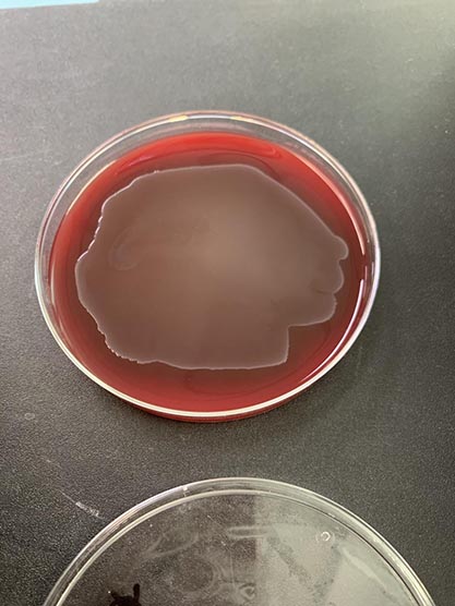 Streptococcus gallolyticus subsp. pasteurianus (Poyart et al.) Schlegel et al.-BNCC