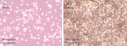 Rat Wistar sarcoma cells-BNCC