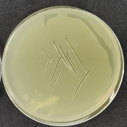 Escherichia coli-BNCC