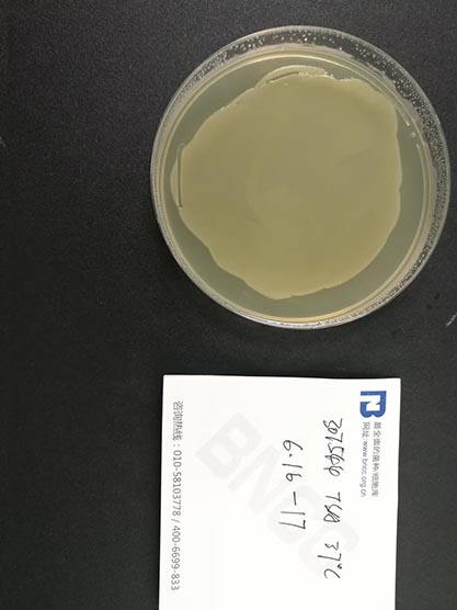 Escherichia coli (Migula) Castellani and Chalmers-BNCC