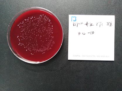 Ruminococcus gnavus Moore et al. VPI C7-9-BNCC