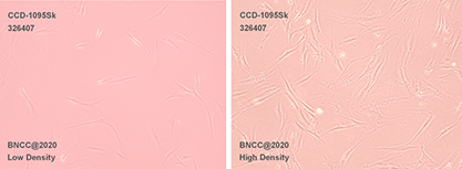Human breast invasive ductal carcinoma adjacent skin cells-BNCC