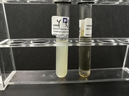 Escherichia coli-BNCC