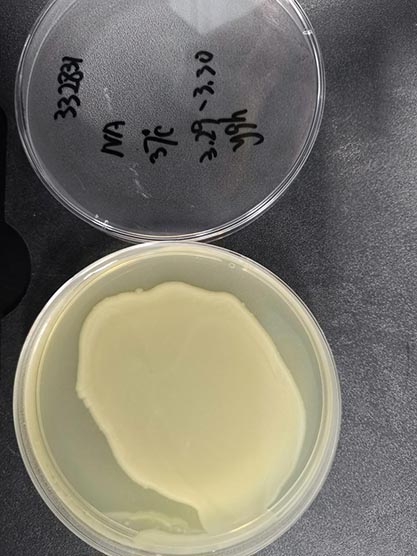 Escherichia coli (Migula) Castellani and Chalmers-BNCC