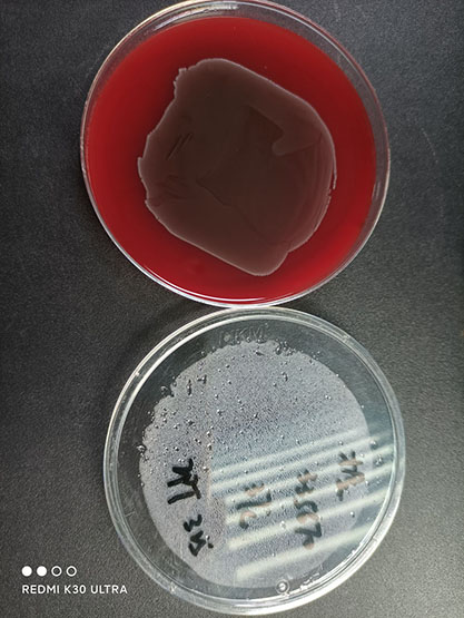 Streptococcus anginosus-BNCC