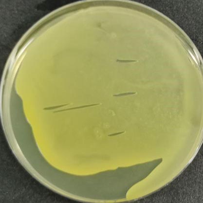 Corynebacterium glutamicum-BNCC