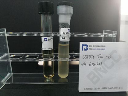 Escherichiacoli(Migula)CastellanietChalmers-BNCC