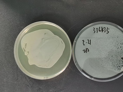 Escherichia coli (Migula)CastellanietChulmers-BNCC