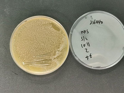 Lactobacillus casei subspp.Casei(Orla-Jensen)Hansen&Lessel-BNCC