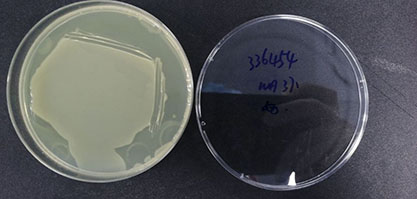 Escherichia coli-BNCC