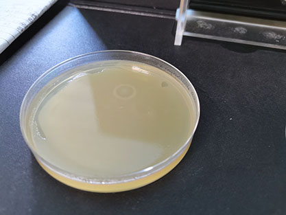 Escherichia coli-BNCC