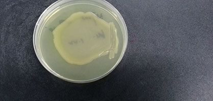 Pseudomonas aeruginosa-BNCC