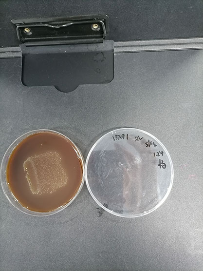 Aggregatibacter actinomycetemcomitans-BNCC