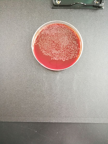 Fusobacterium nuclei subspecies-BNCC