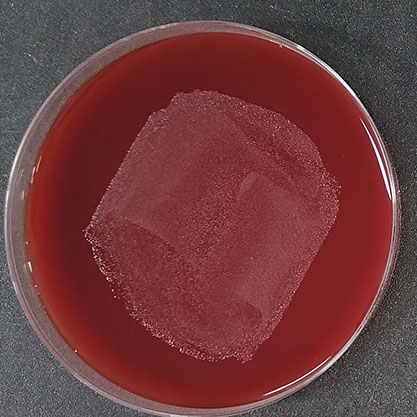 Bacteroides vulgatus-BNCC