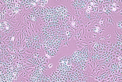 Human melanoma cells-BNCC