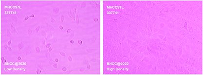 Human low metastatic liver cancer cells-BNCC
