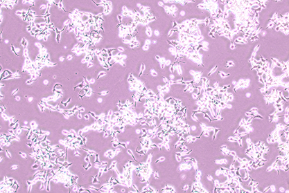 Human nasopharyngeal carcinoma cells-BNCC