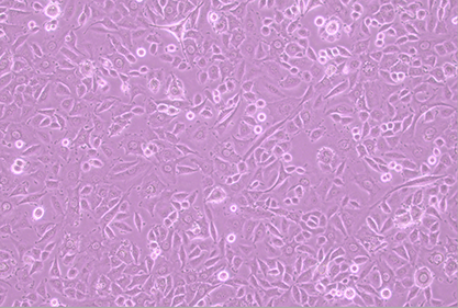 Human cervical squamous cell cancer cell-BNCC