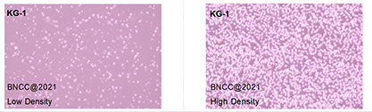 Human acute myelogenous leukemia cells-BNCC