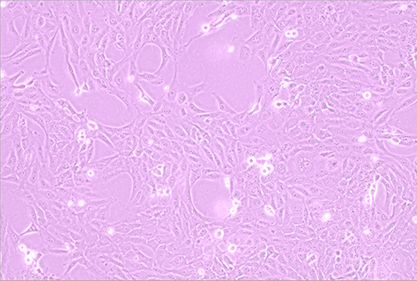 Human gastric mucosal epithelial cells-BNCC