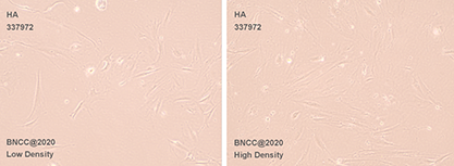 Human amniotic cells-BNCC